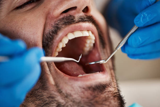 Best Emergency Treatment for Dental Infections or Abscesses in Milwaukie, OR